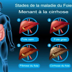 Les clous de girofle sont-ils bons pour la santé du foie ?