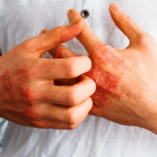 Artémisia Annua : un antimicrobien naturel efficace